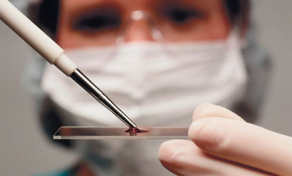 кръвен тест за паразити